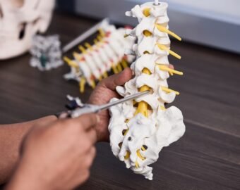 sciatica specialist in chandrapur