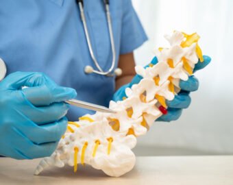Spine and slip disc specialist in balaghat