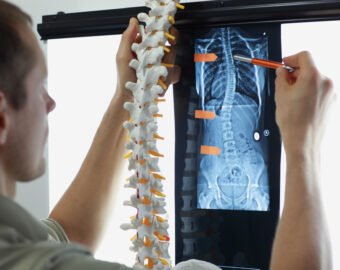 Spine doctor in sagar