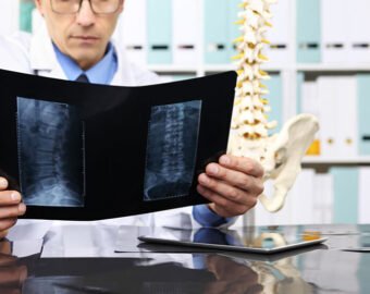 sciatica specialist in katni